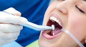 Dental treatment in vadodara