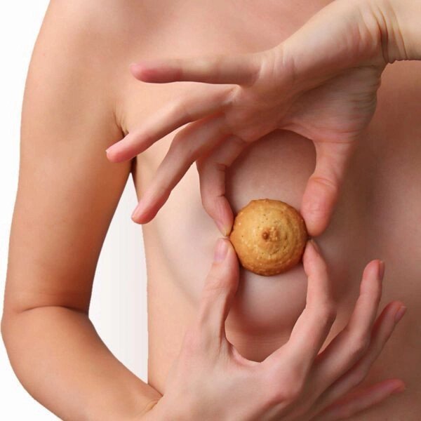 nipple reduction surgery before-https://krishamedspa.in/nipple-reduction-surgery-in-vadodara/