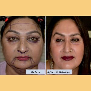 Website photos 2024 01