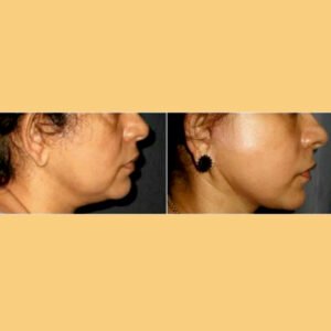 Website photos 2024 03
