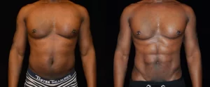 Six Pack (3)
