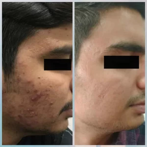 anti-aging-wrinkle(1)