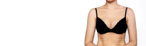 breast reduction page