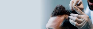 fue hair transplant page