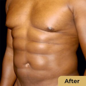 6 pack 01