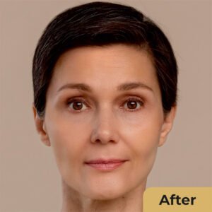 Anti Aging 01