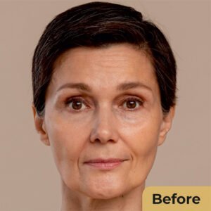 Anti Aging 02