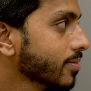 Beard 01