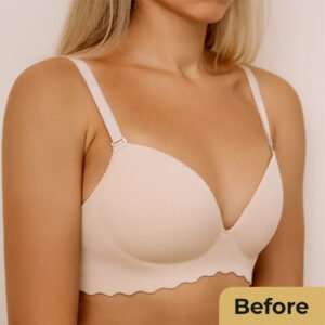 Breast enlargement 01
