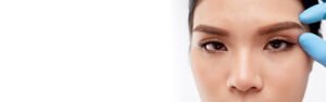 Brow Lift