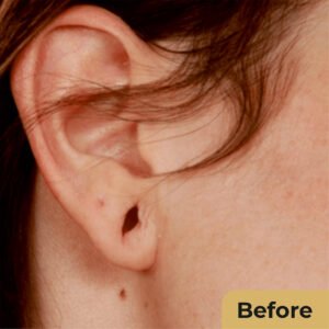 Ear lope Repair 01