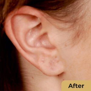 Ear lope Repair 02