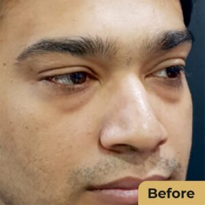 Eye lid 01