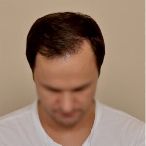 Fue Hair 02