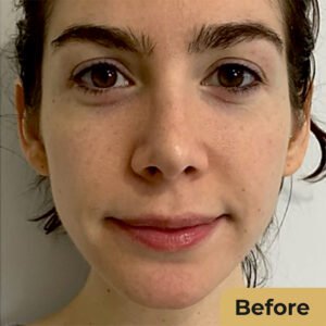 Glutathione 01