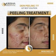 peeling treatment before/after