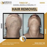 laser hair removal before/after