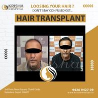 hair transplant before/after