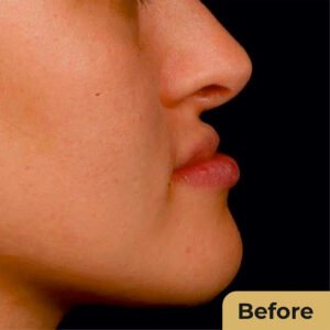 Jaw Contour 01