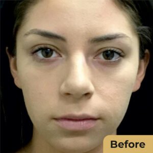 Skin Whitening 01