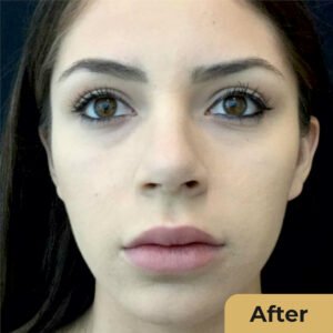 Skin Whitening 02