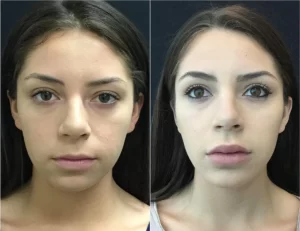 Skin Whitening Treatment(5)