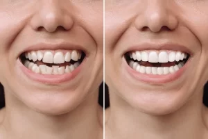 cropped-shot-young-caucasian-smiling-600nw-2328458421