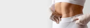 tummy tuck page