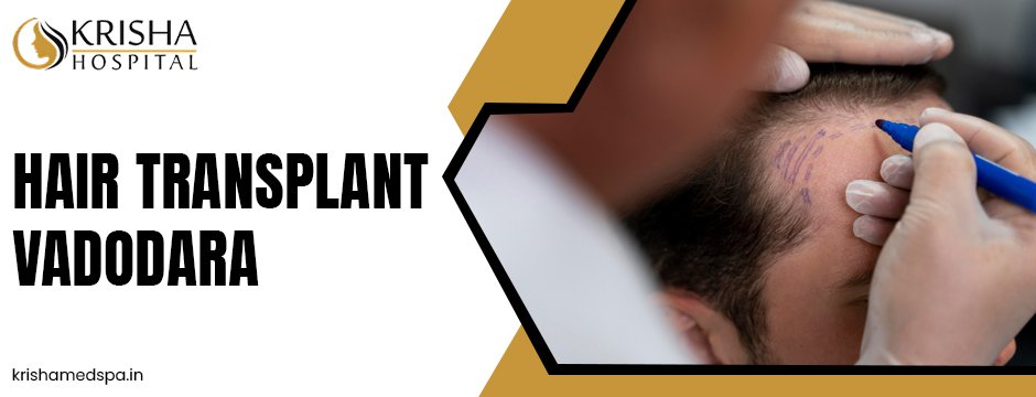 Hair Transplant Vadodara