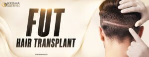 Fut Hair Transpant
